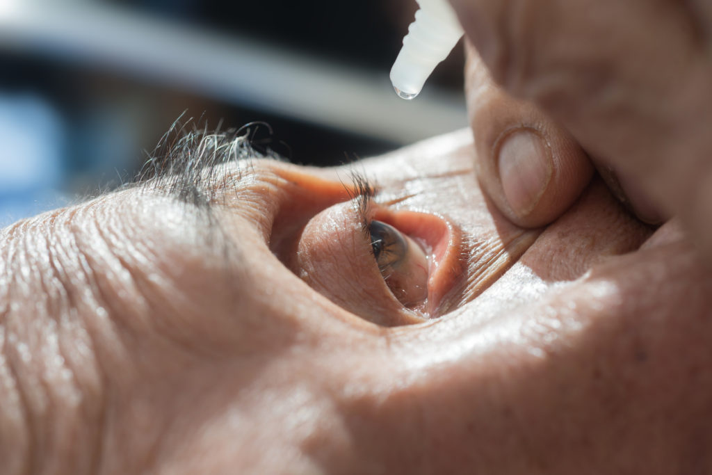 FDA Approves New Treatment for Keratoconus Island Eye